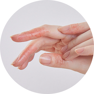 Bepanthen on hand